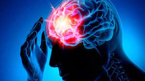 29 жовтня - Всесвітній День боротьби з інсультом  #ЗдоровішіРазом